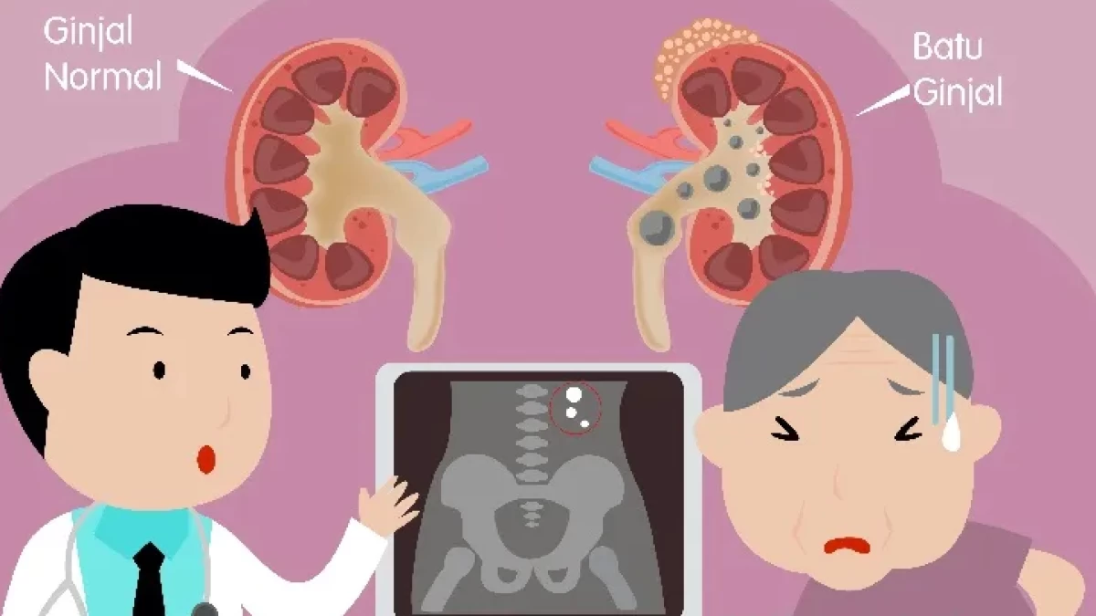 Preventif Agar Ginjal Tidak Terganjal