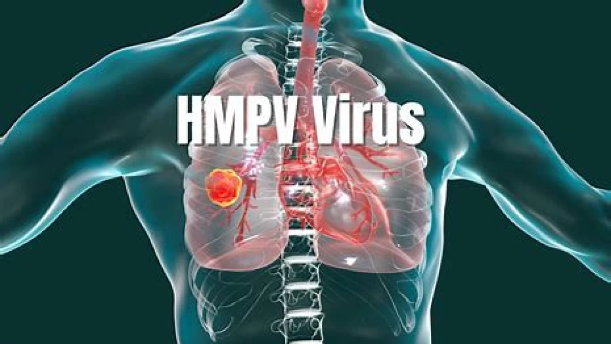 Tenang! Begini Alasan Kenapa HMPV Tidak Berpotensi Menjadi Pandemi