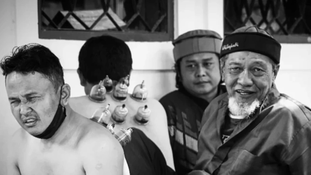 Pengobatan Terapi Bekam dan Anjuran Langsung Rasulullah