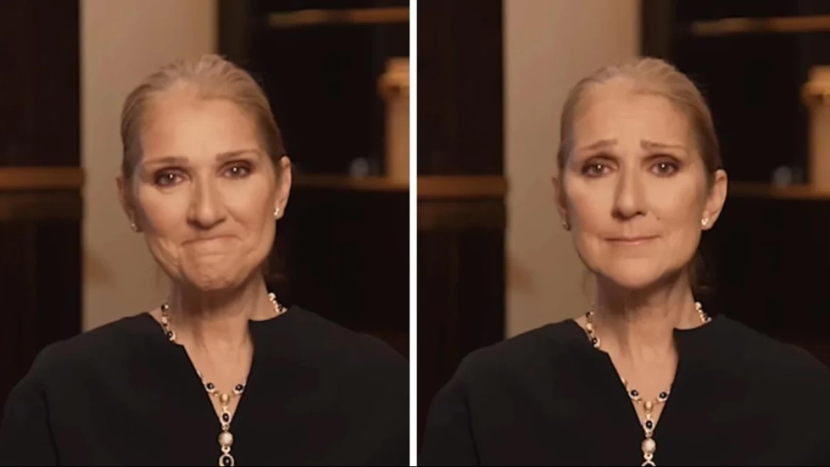 Mengenal Stiff Person Syndrome, Kelainan Saraf Langka yang Menyerang Celine Dion