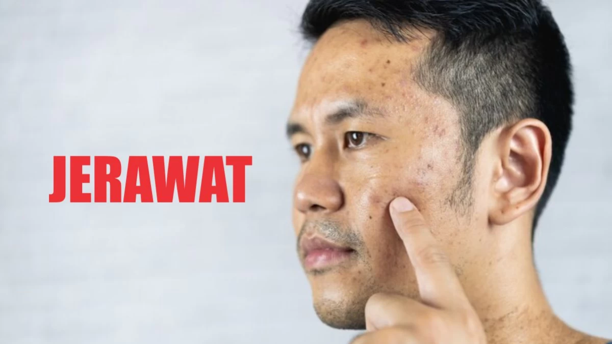 Cara dan Doa Menghilangkan Jerawat, Bisul, dan Penyakit Kulit Lainnya