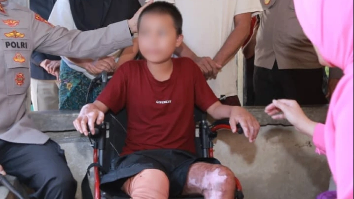 Dugaan Pembakaran 3 Santri di NTB, DPR Ingatkan Tidak Digeneralisasi Jadi Gambaran Seluruh Pesantren