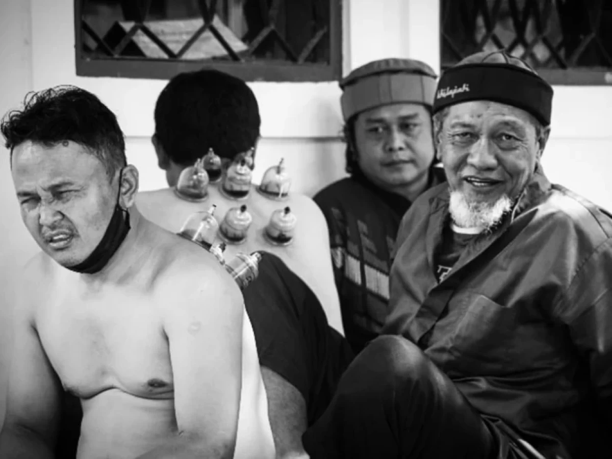 Pengobatan Terapi Bekam dan Anjuran Langsung Rasulullah