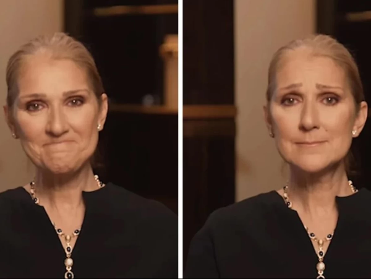 Mengenal Stiff Person Syndrome, Kelainan Saraf Langka yang Menyerang Celine Dion