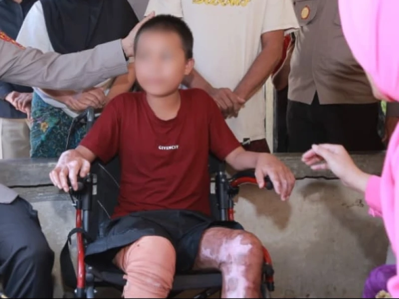Dugaan Pembakaran 3 Santri di NTB, DPR Ingatkan Tidak Digeneralisasi Jadi Gambaran Seluruh Pesantren